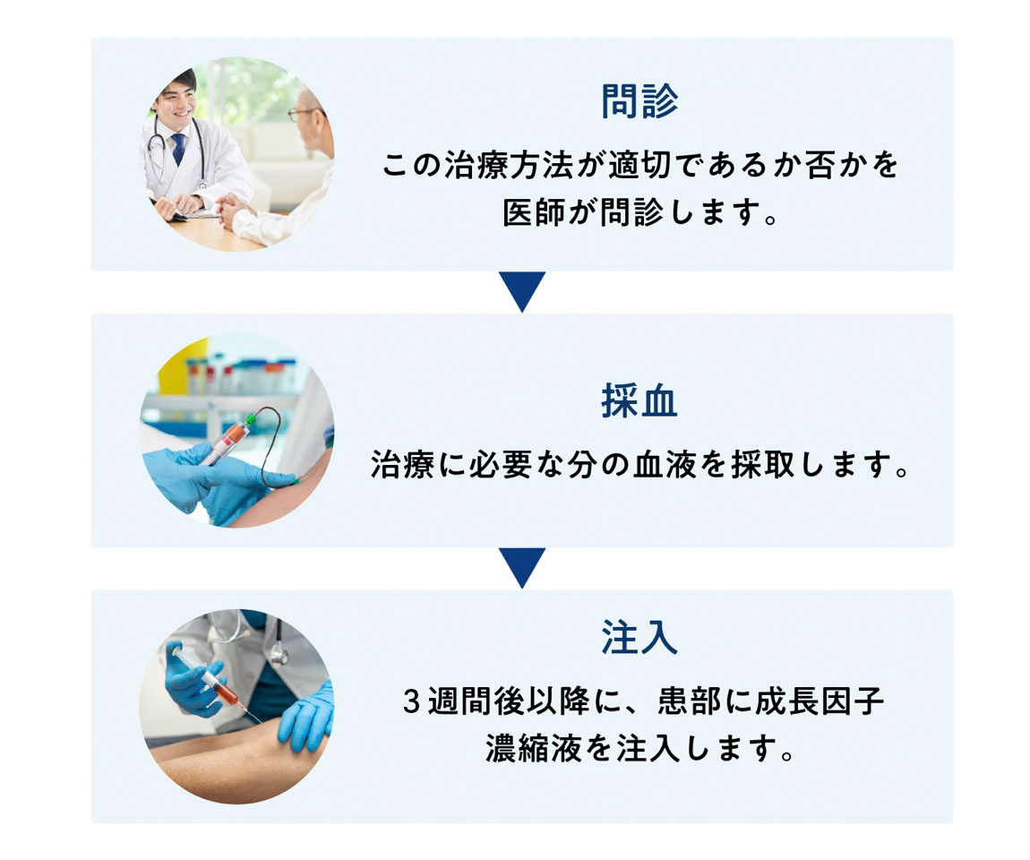 PDF-FD療法の流れ 問診、採血、注入